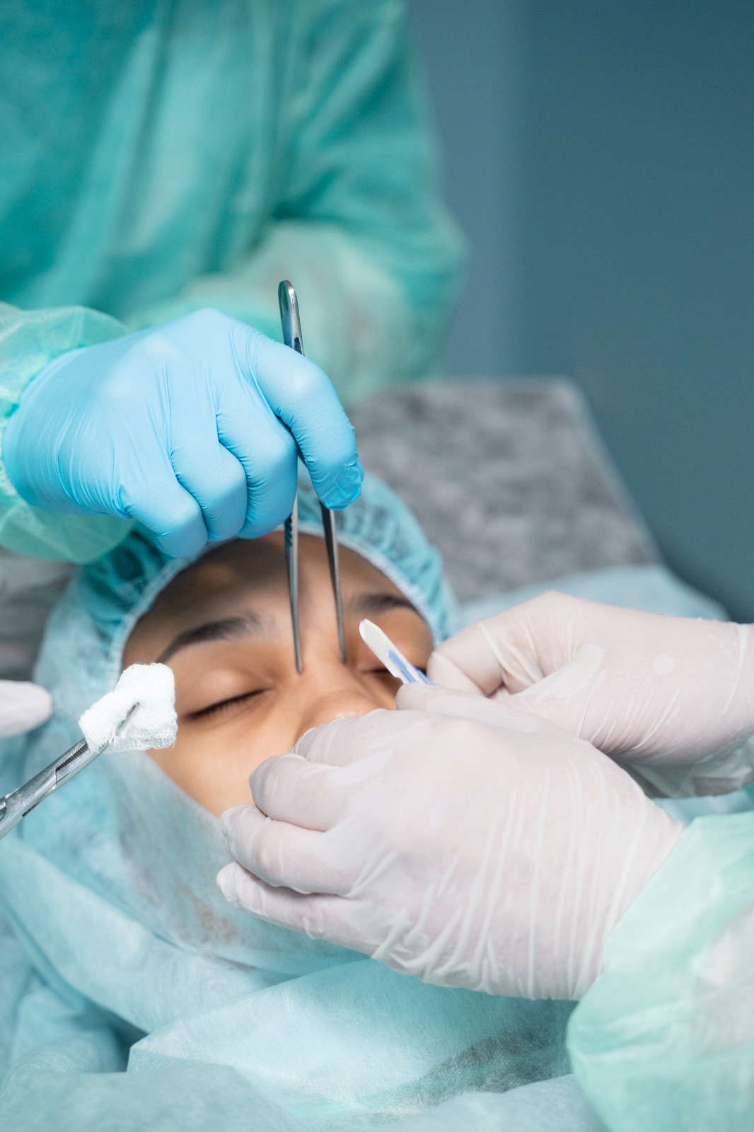 Minor surgical procedure — lipoma and mole removal at Serenova Aesthetics, Bangalore