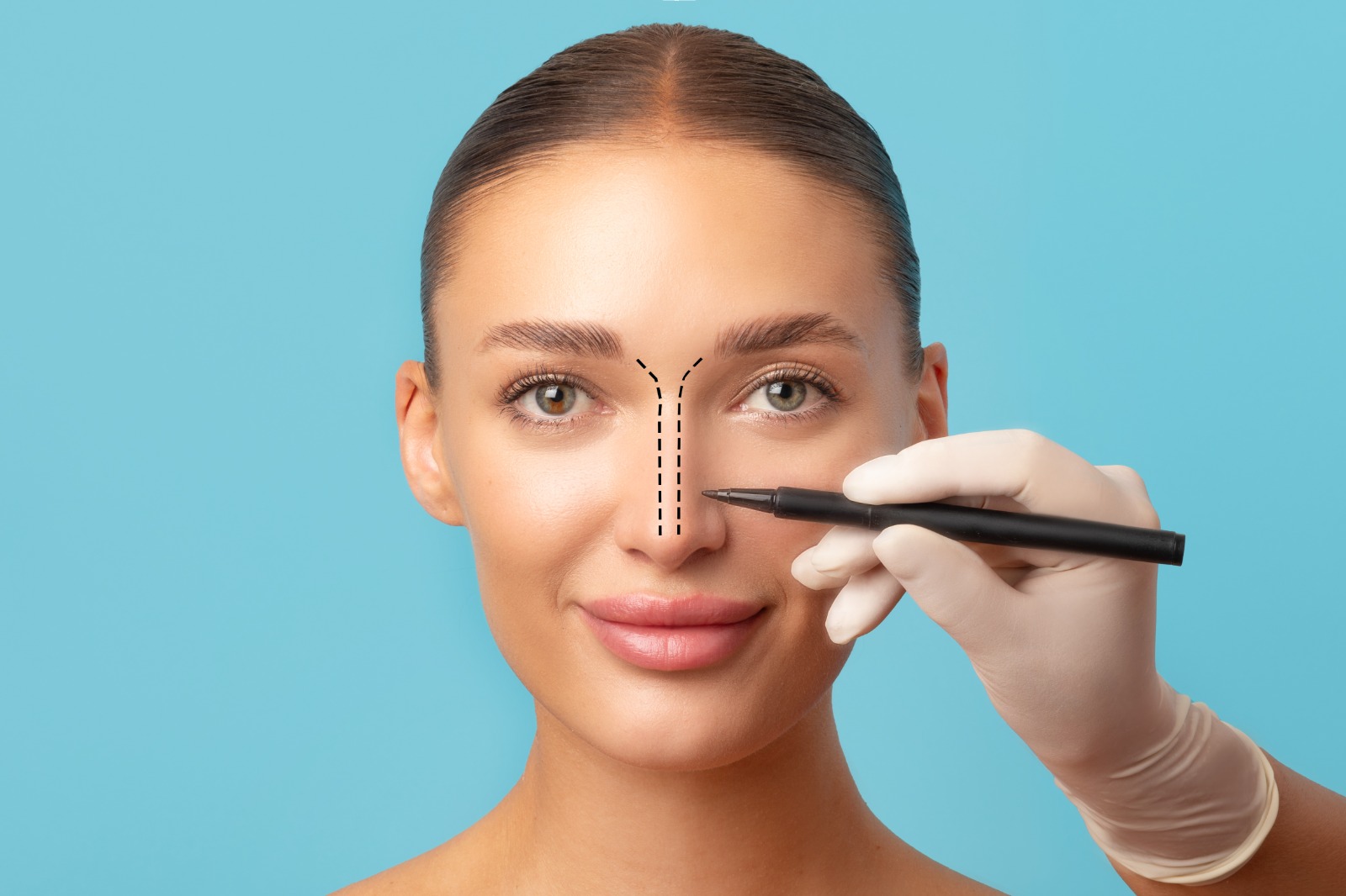Rhinoplasty (nose reshaping) consultation and planning at Serenova Aesthetics, Bangalore